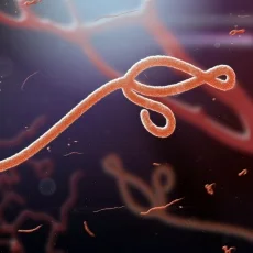 Imagen informativa sobre Ebola