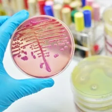 Imagen informativa sobre Enfermedades infecciosas