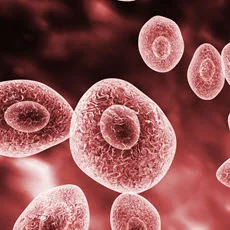 Imagen informativa sobre Infecciones por Pneumocystis
