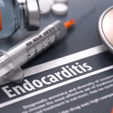 Imagen informativa sobre Endocarditis